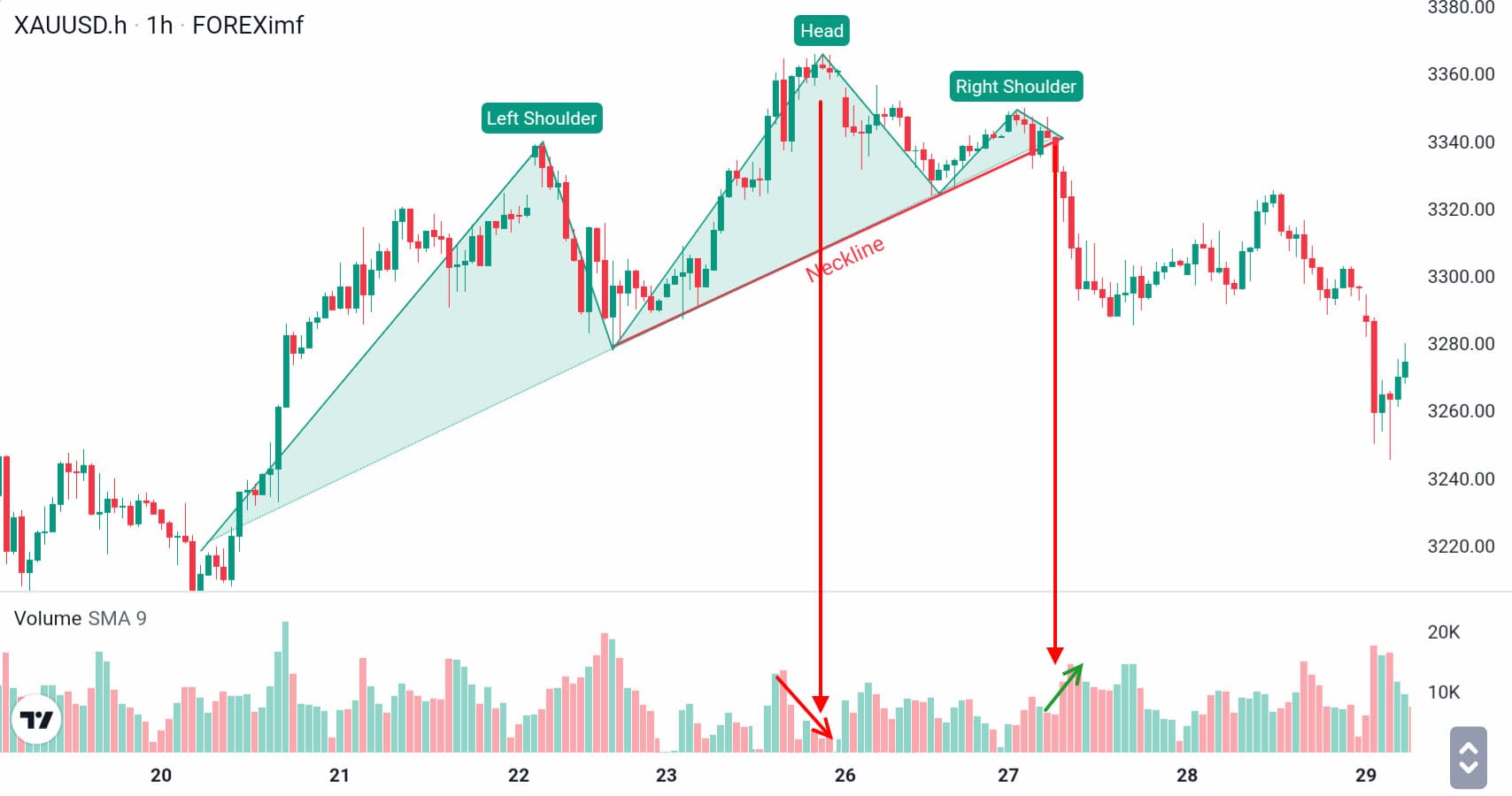 Pattern XAUUSD